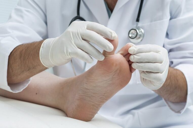 L'esame del medico da parte della presenza di micosi
