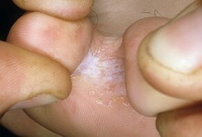 Terapia delle persone