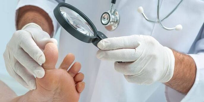 il medico esamina i piedi per individuare i funghi tra le dita