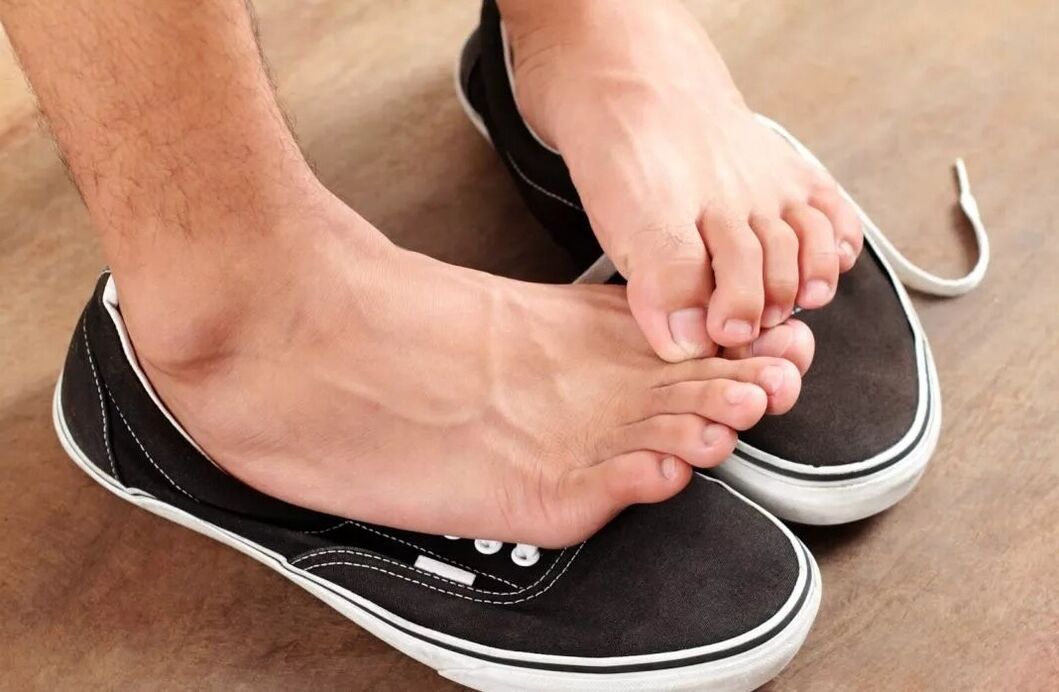 prurito ai piedi a causa di funghi tra le dita